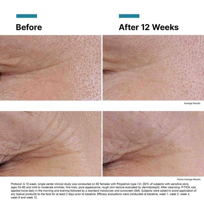 SkinCeuticals P-TIOX Peptides available to buy online from RENU Laser & Skin in Mill Bay, BC on Vancouver Island