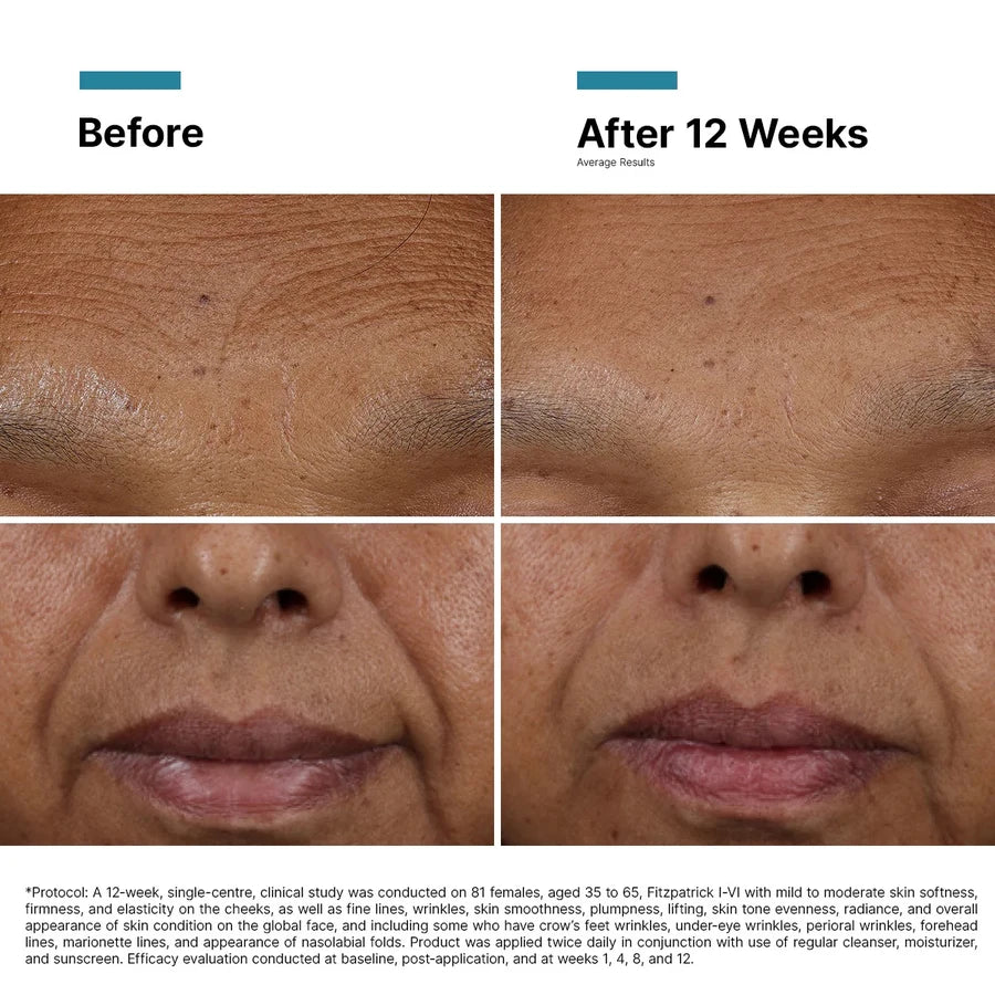 SkinCeuticals HA Intensifier Multi-Glycan Skincare available to buy online from RENU Laser & Skin in Mill Bay, BC on Vancouver Island