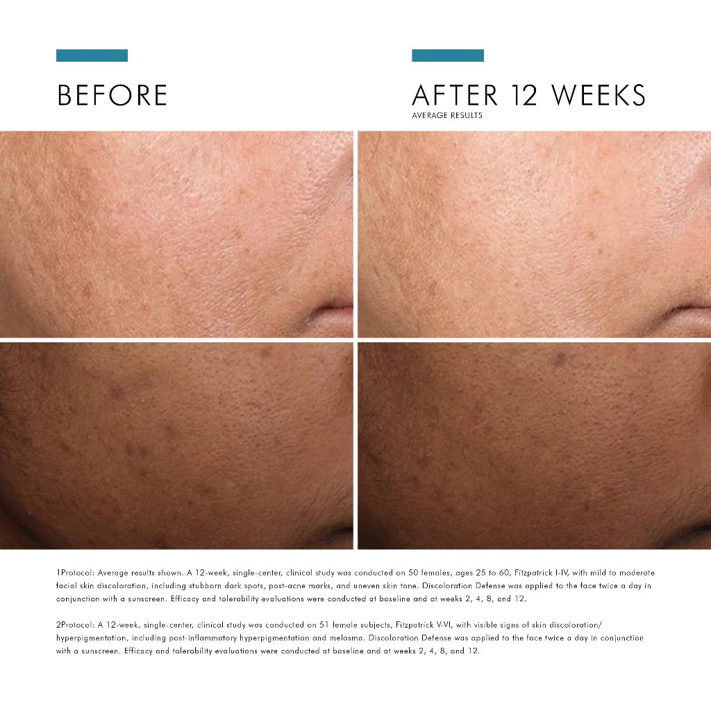 SkinCeuticals Discolouration Defense Daily Serum Serum available to buy online from RENU Laser & Skin in Mill Bay, BC on Vancouver Island