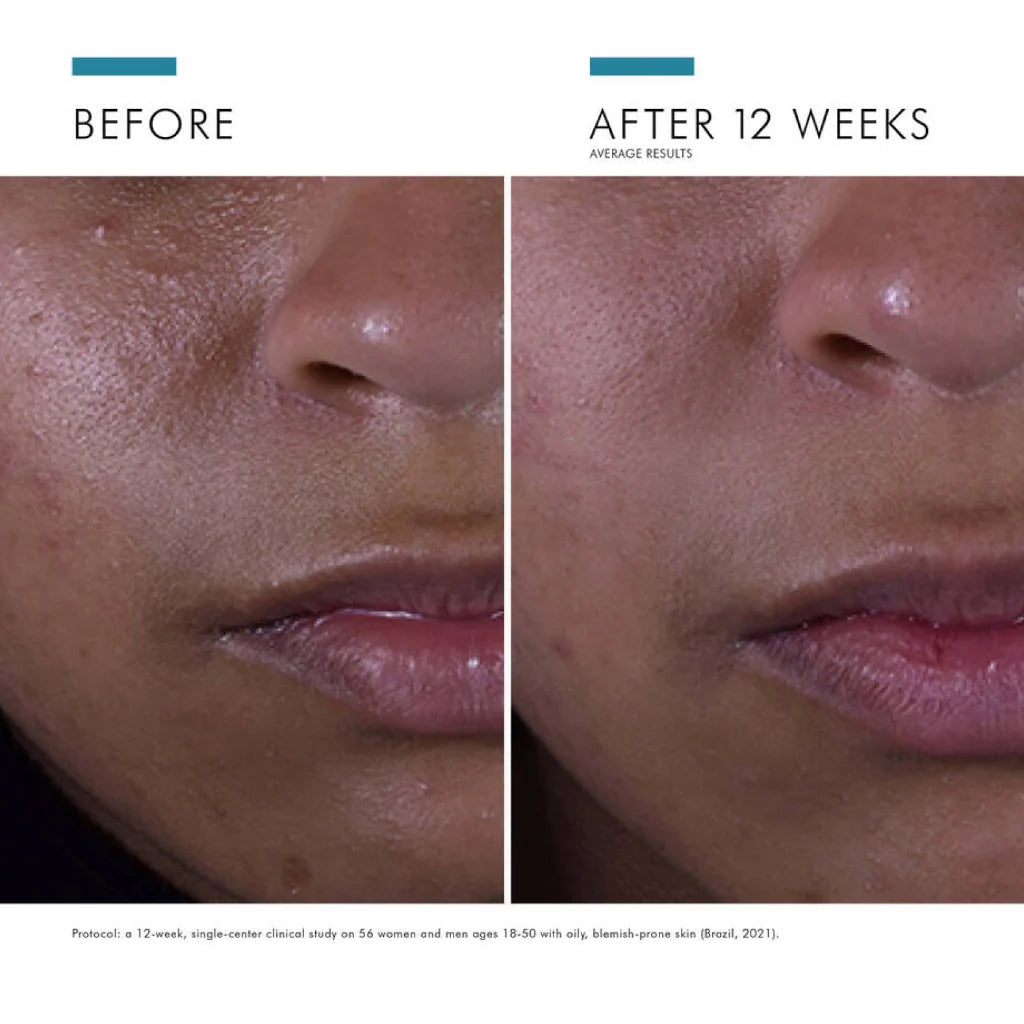 SkinCeuticals Silymarin CF Skincare available to buy online from RENU Laser & Skin in Mill Bay, BC on Vancouver Island